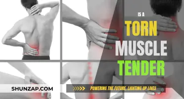 Muscle Tears: Tender, Painful, and Inflamed