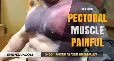Torn Pectoral Muscle Pain: Symptoms, Causes, and Recovery Insights