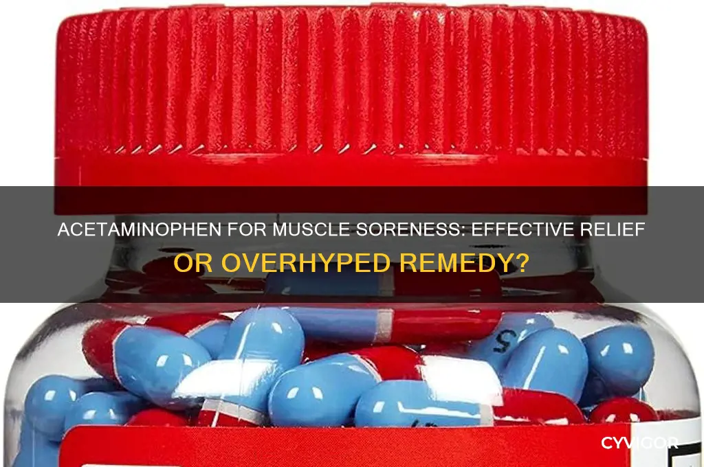 is acetaminophen good for muscle soreness