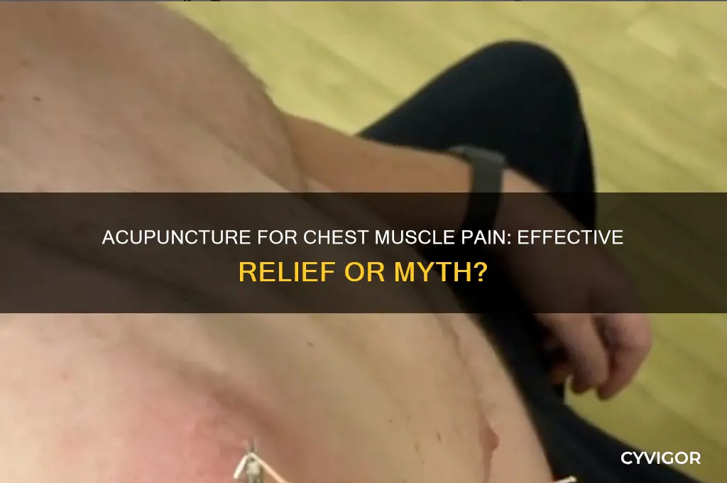 is acupuncture good for chest muscle pain