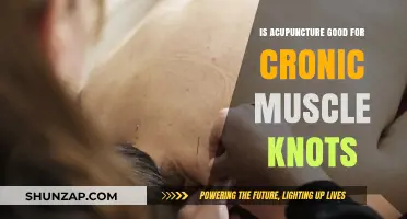 Acupuncture for Chronic Muscle Knots: Effective Relief or Myth?