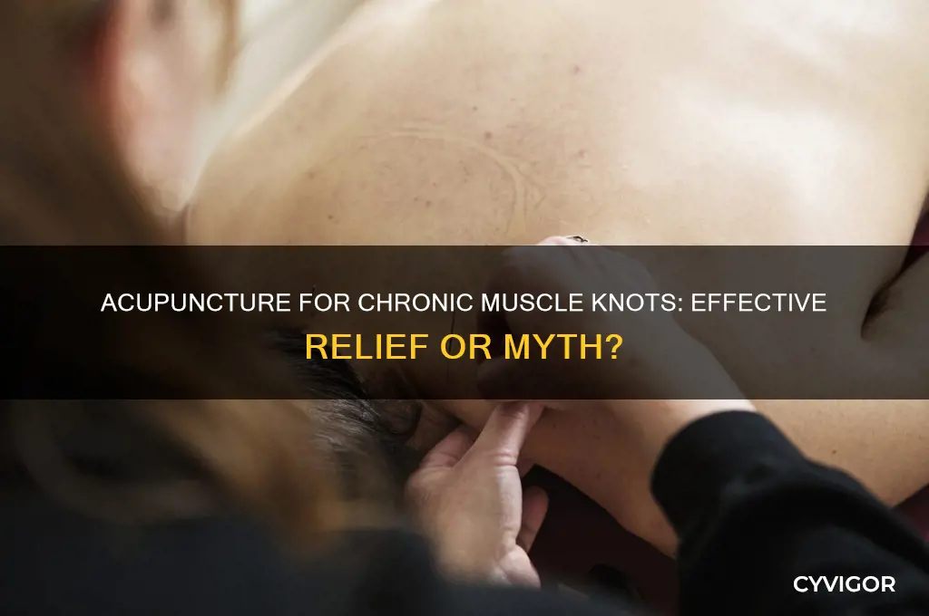 is acupuncture good for cronic muscle knots