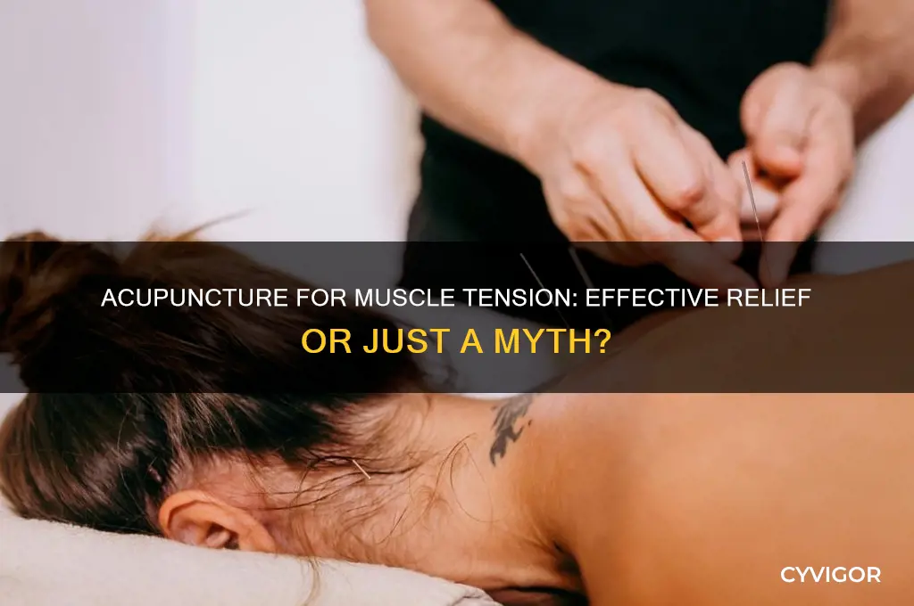 is acupuncture good for muscle tension