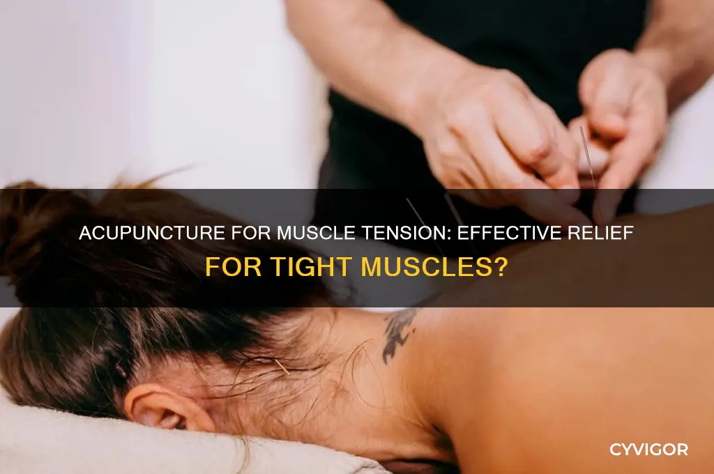 is acupuncture good for tight muscles
