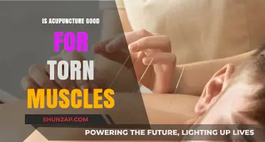 Acupuncture for Torn Muscles: Effective Healing or Just a Myth?