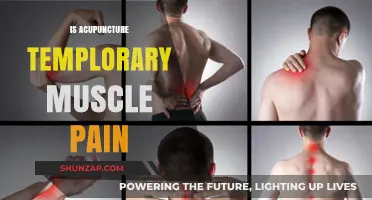 Acupuncture for Temporary Muscle Pain: Effective Relief or Short-Term Fix?