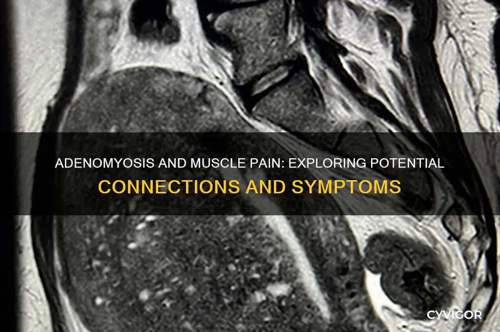 is adenomyosis related to other muscle pain