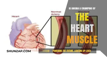 Understanding Angina: Is It Really a Cramping of the Heart Muscle?