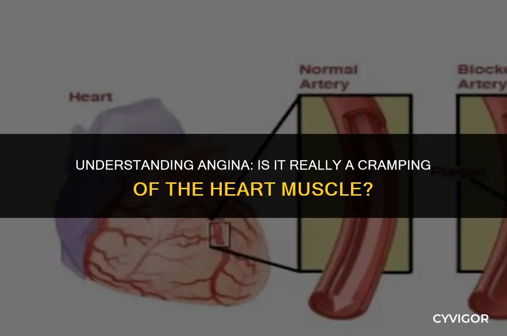 is angina a cramping of the heart muscle