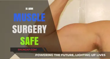 Is Arm Muscle Surgery Safe? Risks, Benefits, and Recovery Explained