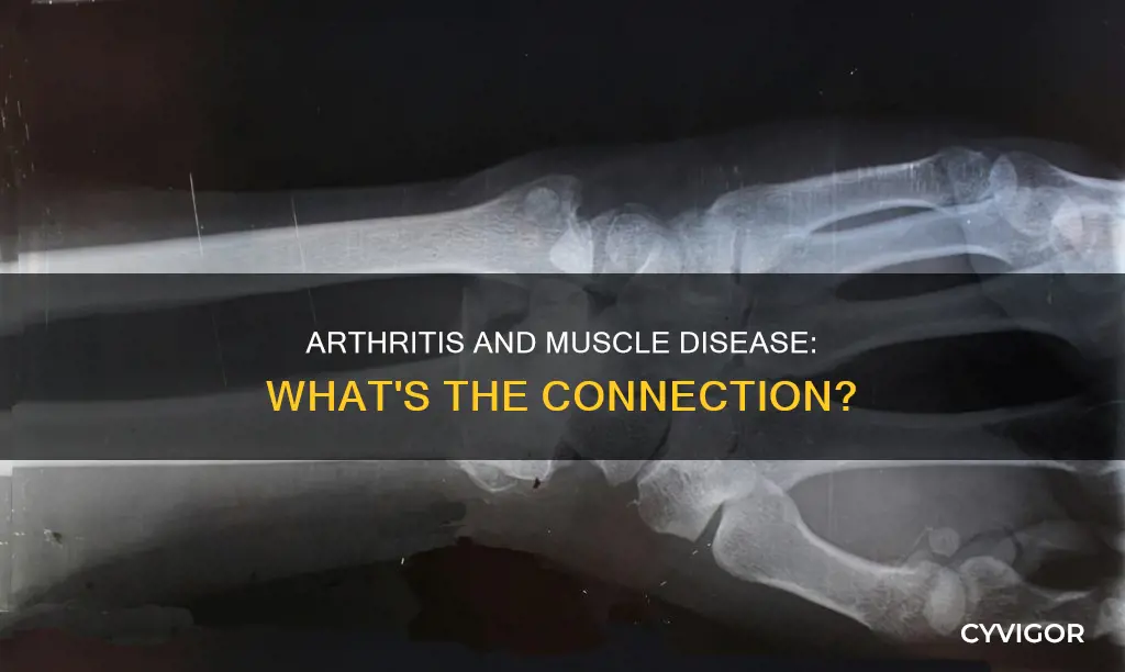 is arthritis a muscle disease