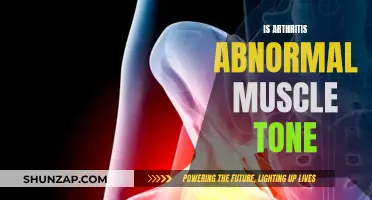 Arthritis and Muscle Tone: What's the Abnormal Link?