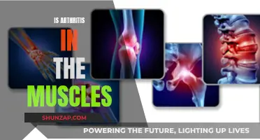 Arthritis and Muscles: What's the Connection?