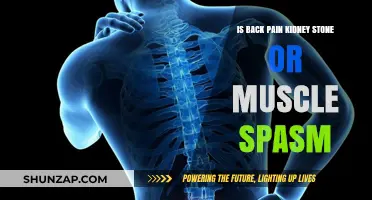 Back Pain: Kidney Stone or Muscle Spasm? How to Tell