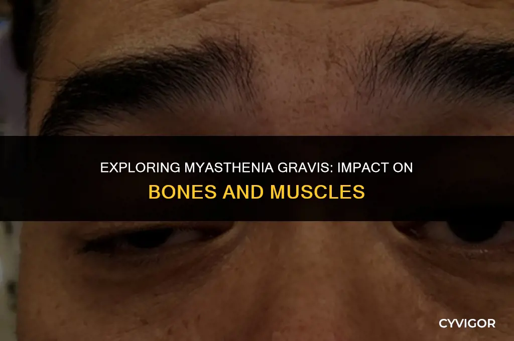 is bone and muscles affected by myasthenia gravis