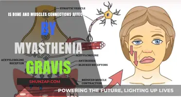 Exploring Myasthenia Gravis: Impact on Bone and Muscle Connections