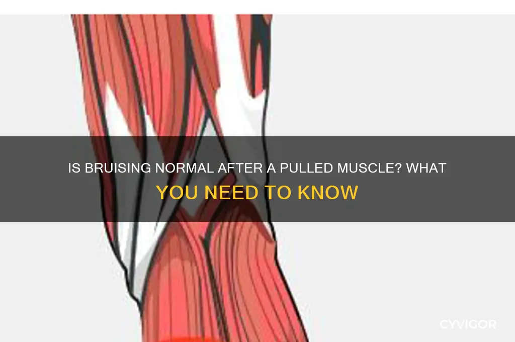 is bruising normal after a pulled muscle