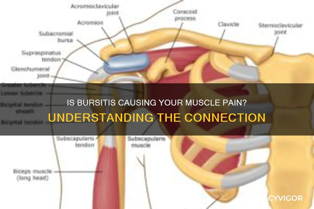 is bursitis muscle pain