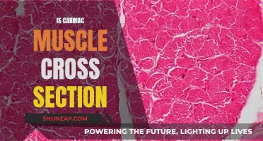 The Intriguing Cross-Section of Cardiac Muscle Fibers