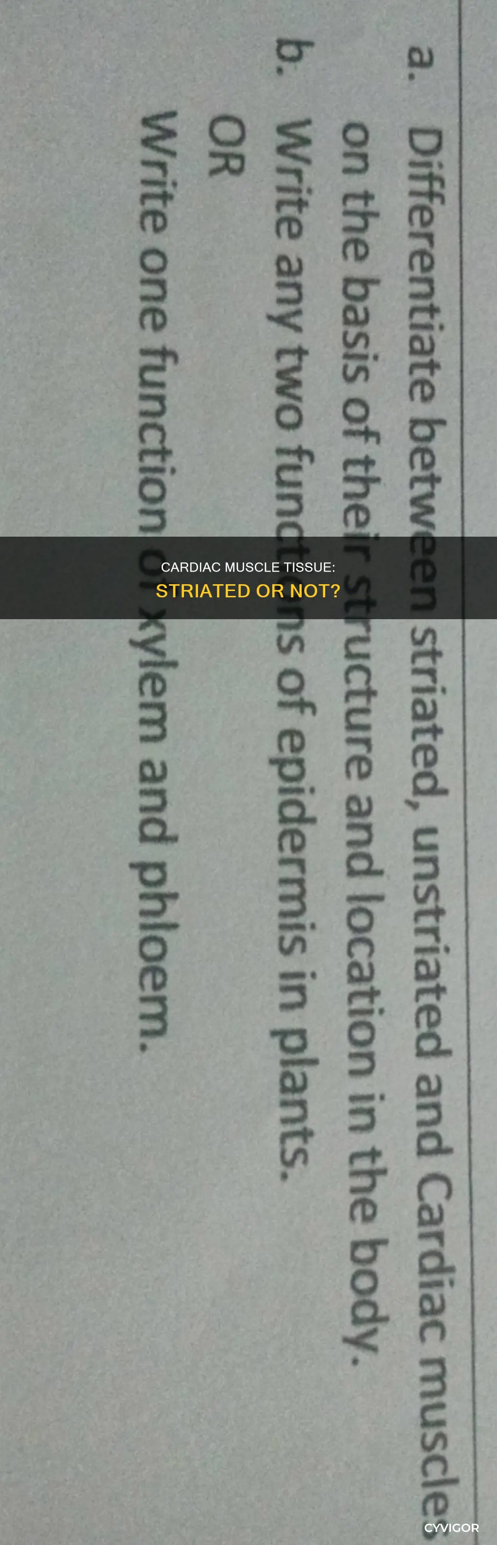 is cardiac muscle nonstriated