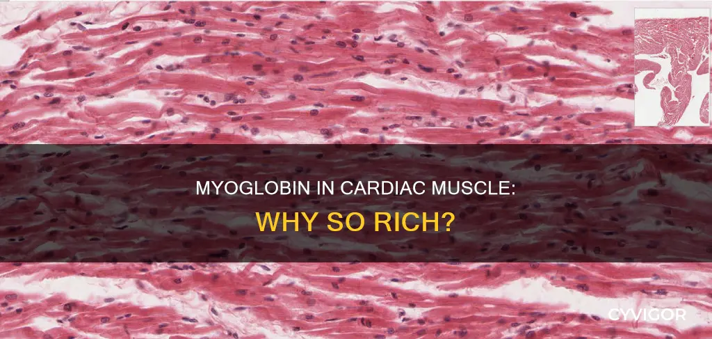 is cardiac muscle rich myoglobin