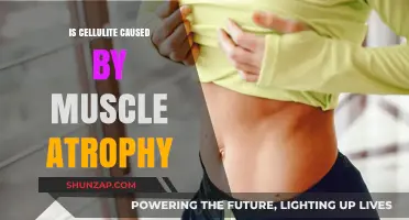 How Muscle Atrophy and Cellulite Are Linked