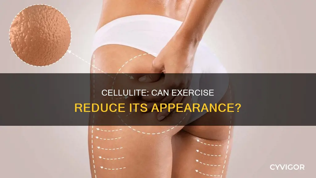 is cellulite caused by not exercising the muscles