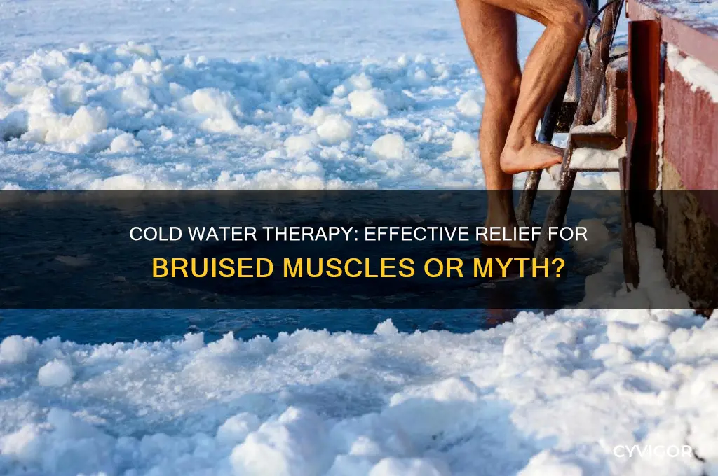 is cold water good for bruised muscles