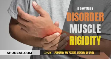 Muscle Rigidity and Conversion Disorder: What's the Link?