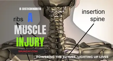 Understanding Costochondritis: Muscle Injury or Something Else?