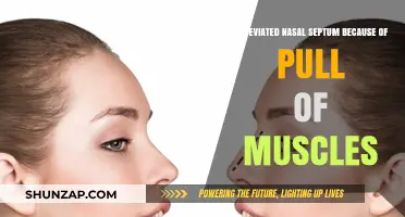 Deviated Nasal Septum: Muscle Pull or Other Causes?