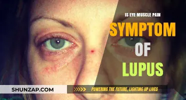 Eye Muscle Pain and Lupus: Understanding the Potential Connection