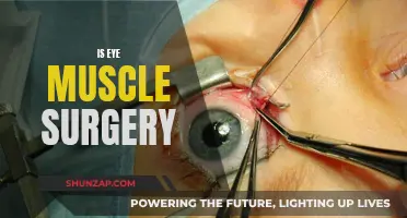 Eye Muscle Surgery: Is it Worth the Risk?