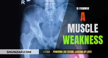 Fosamax and Muscle Weakness: What's the Real Link?