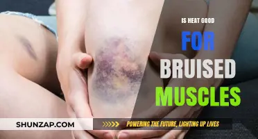 Heat Therapy for Bruised Muscles: Benefits, Risks, and Best Practices