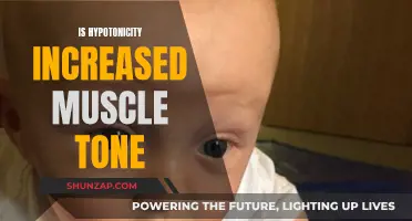 Muscle Tone and Hypotonicity: Understanding the Paradox
