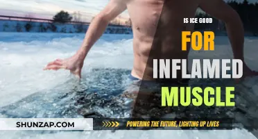 Is Ice Therapy Effective for Soothing Inflamed Muscles? Expert Insights