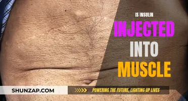 Insulin Injections: Muscle or Fat Tissue?