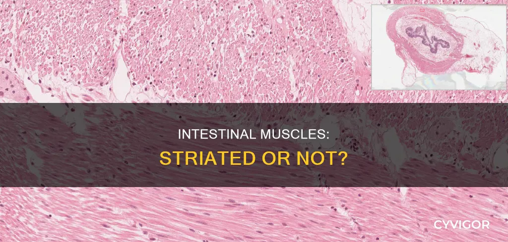 is intestinal muscle striated