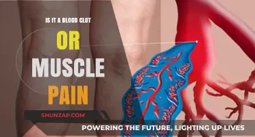 Blood Clot or Muscle Pain: How to Tell the Difference