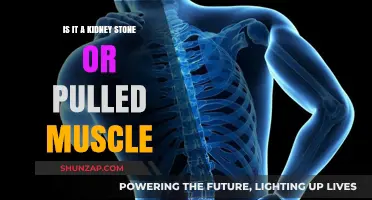 Kidney Stone or Pulled Muscle: Identifying Your Lower Back Pain