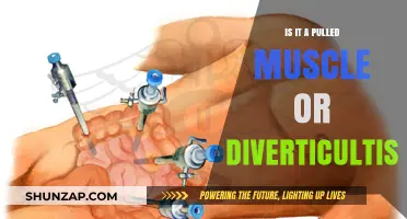 Pulled Muscle or Diverticulitis: Identifying Your Pain and Next Steps