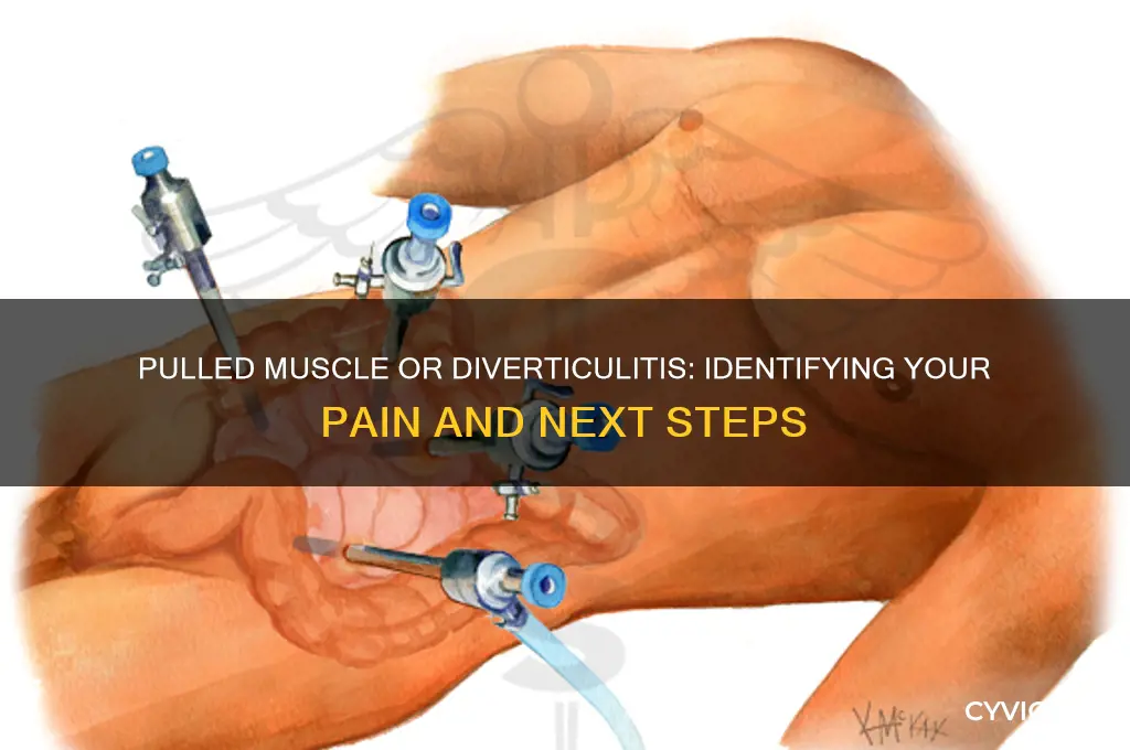 is it a pulled muscle or diverticultis