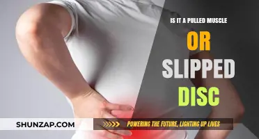 Pulled Muscle vs. Slipped Disc: Identifying Your Back Pain Cause