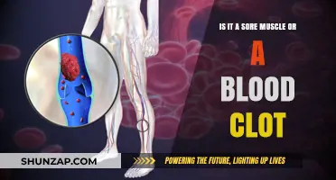 Sore Muscle or Blood Clot: How to Tell the Difference