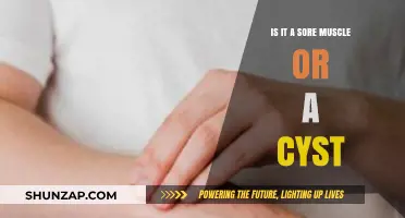 Sore Muscle or Cyst? How to Tell the Difference and When to Worry