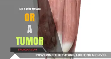 Sore Muscle or Tumor: How to Tell the Difference and When to Worry