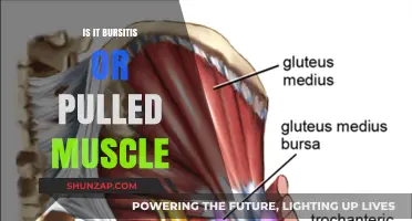 Bursitis vs. Pulled Muscle: Identifying Your Pain and Treatment