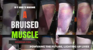 Massaging Bruised Muscles: Benefits, Risks, and Healing Tips