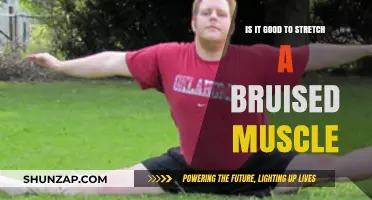 Should You Stretch a Bruised Muscle? Healing Tips and Precautions